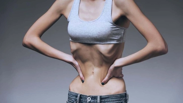 Beden algısını bozan ve insanı ölüme götüren hastalık: Anoreksiya