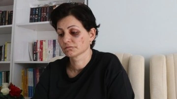 Burdur'da vahşet! Anne ve kızı döve döve hastanelik ettiler
