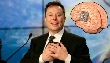 Elon Musk’ın beyin çipi ilk kez bir insana yerleştirildi